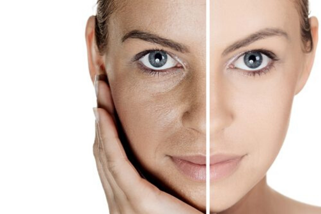 Improves skin texture