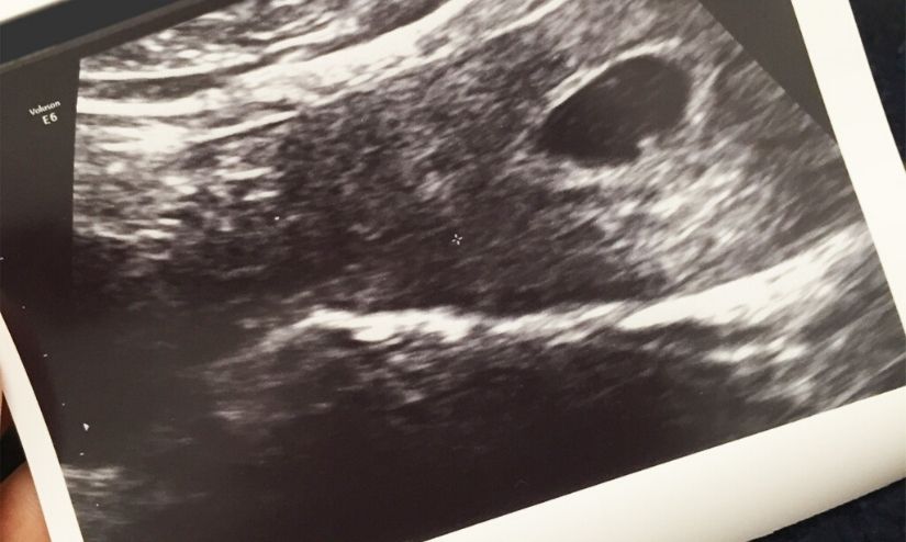 Early Scan