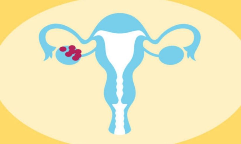 Obesity Can Affect Your Hormones