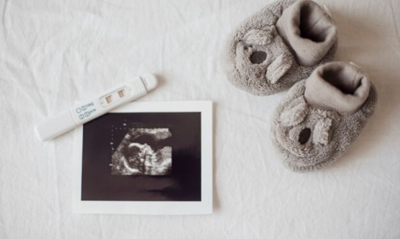 Some Common Tests That Should Positively Be Done During Pregnancy