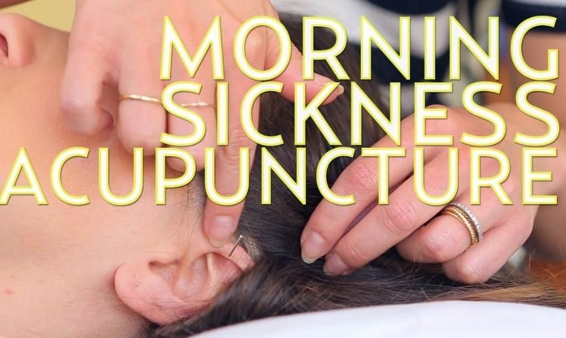 Acupuncture A Way To Reduce The Effects Of Morning Sickness Easily