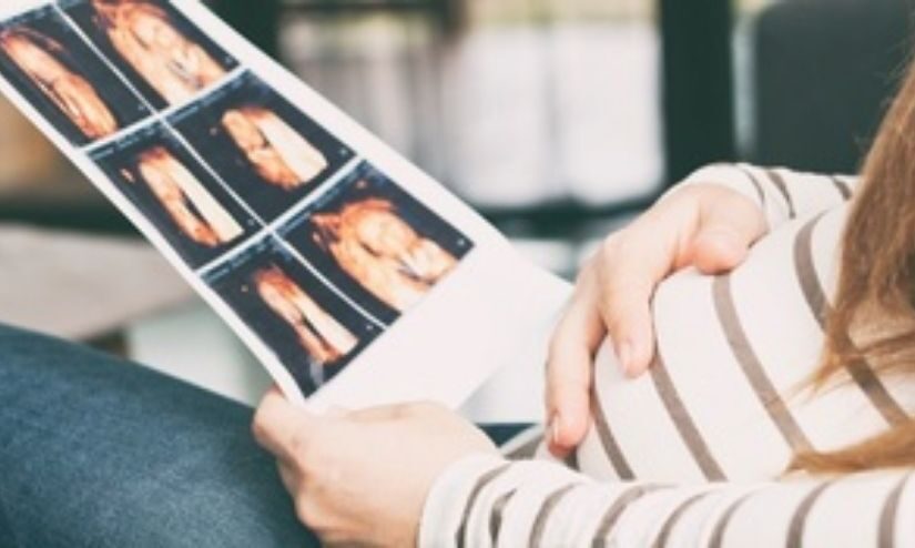 What Can A 4D Scan Tell You About Your Baby