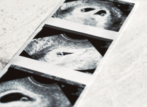 fourth Scan