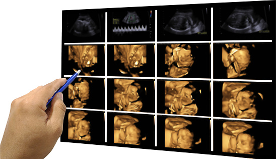 4D Well-being scan in Milton Keynes