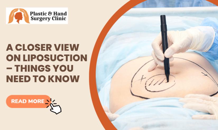 cosmetic surgeon in kolkata