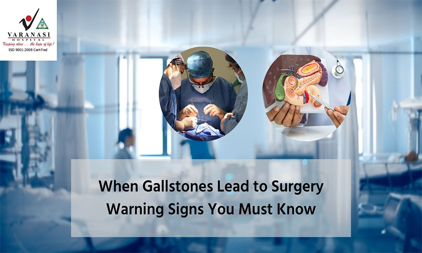 When Gallstones Lead to Surgery: Warning Signs You Must Know