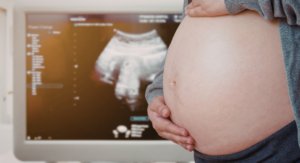 4D Baby Scan