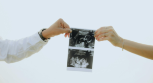 4D Baby Scan